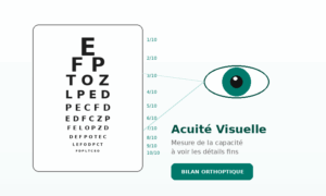 acuite visuelle
